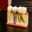 Orthodontics: