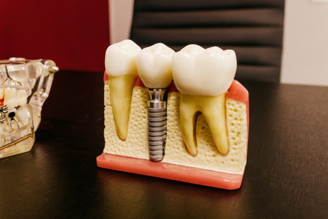 <strong>Orthodontics: Improving Your Smile and Oral Health</strong>